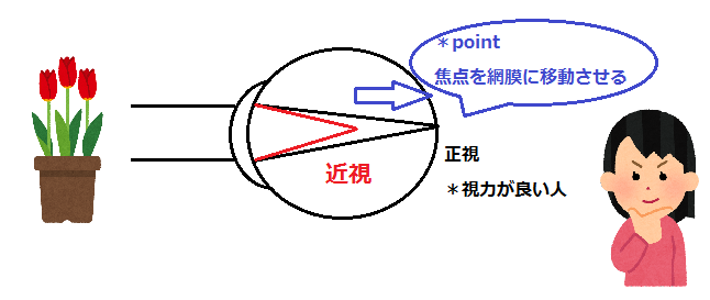 近視の仕組み